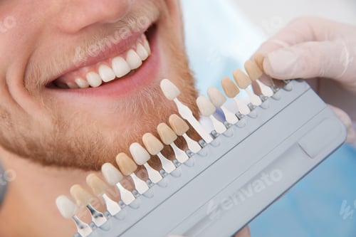 Preview: Dentist selecting patient's teeth color with palette in clinic, closeup