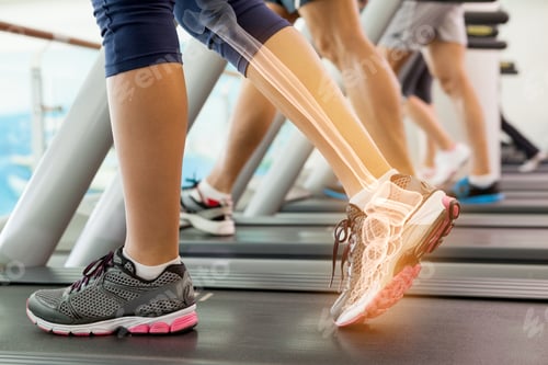 Preview: Digital Composite Of Highlighted Ankle Of Woman On Treadmill