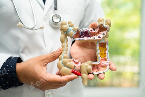 Preview: Intestine, appendix and digestive system, doctor holding anatomy model for study diagnosis