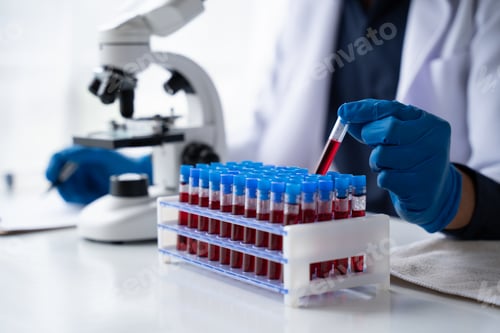 Preview: Doctor hand taking a blood sample tube from a rack with machines of analysis in the lab background