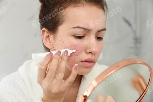 Preview: Teen girl with acne problem applying cream using mirror in bathroom