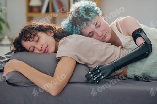 Preview: Young serene woman with myoelectric hand embracing her girlfriend