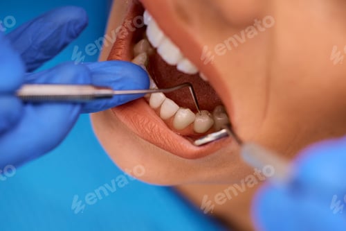Preview: Close up of woman having teeth check-up at dentist's office.