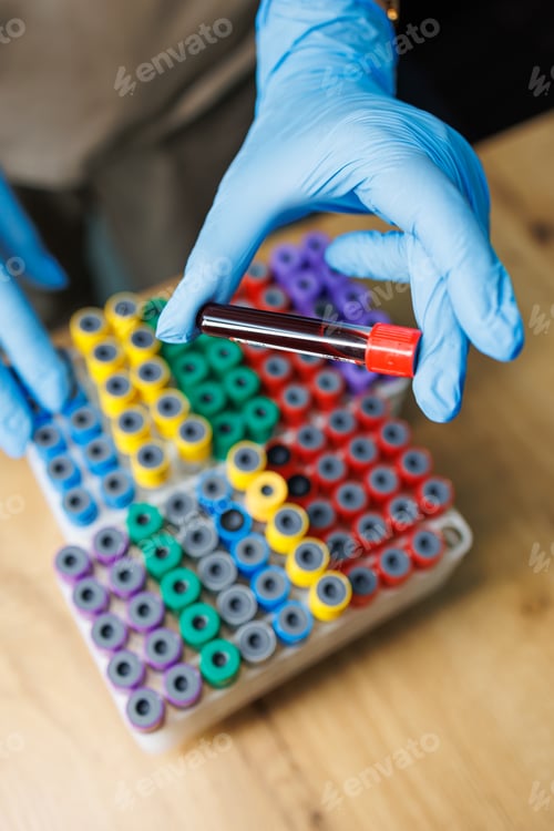 Preview: Test tubes with blood. Taking blood from a vein for research