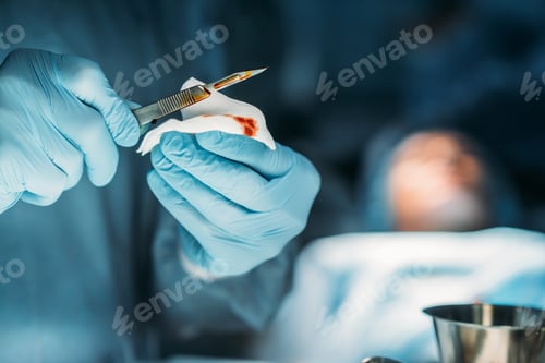 Preview: Surgeon's Gloved Hands Holding Scalpel in Operating Room