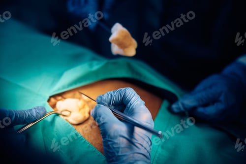 Preview: Close up of surgical procedure in the hospital.