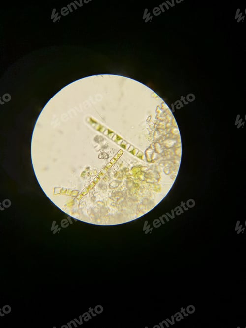 Preview: Algae viewed under the microscope