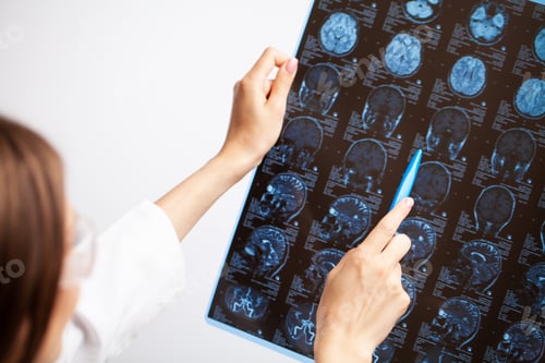 Preview: Doctor examines an MRI image of the patient's head