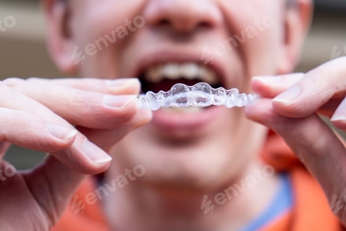 Preview: Man holds put on invisible braces. Invisalign plastic removable braces