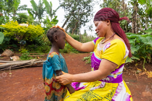 Preview: Young African albino mother rests her hand on her baby girl's head as she talks to her