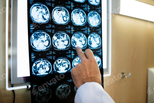 Preview: Brain CT scan x-ray film