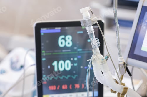 Preview: Ventilator tubing with patient monitor in modern hospital surgery unit