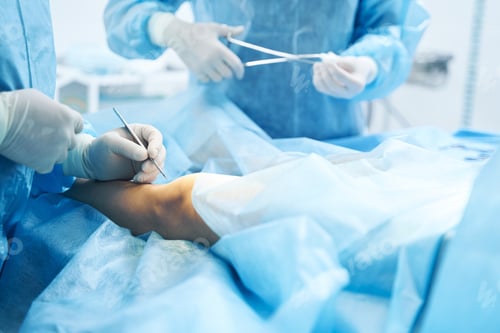 Preview: Surgeons Performing Operation in Hospital Operating Room