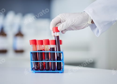 Preview: Hand, doctor and blood in test tube, health and sample for experiment with medical research in lab.