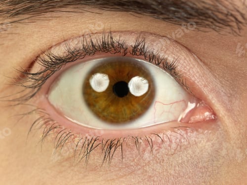 Preview: Brown eye