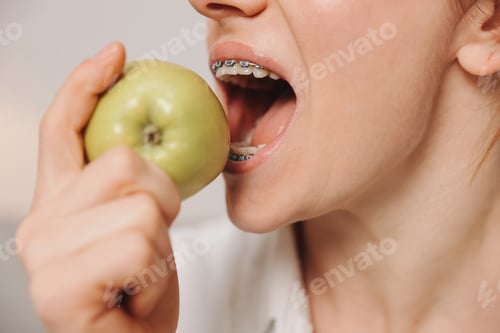Preview: Portrait of mature woman with braces on teeth eating green apple