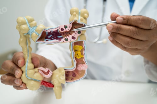 Preview: Intestine, appendix and digestive system, doctor holding anatomy