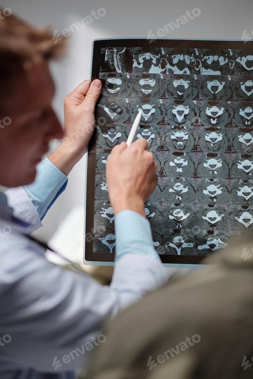 Preview: Radiologist Showing Spine Discs Xray