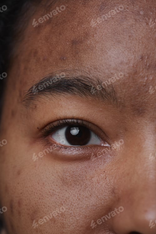 Preview: Real Skin Texture