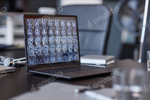 Preview: Open Laptop Showing X Ray Scan of Patients Brain on Meeting Table in Clinic