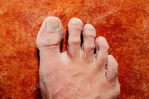 Preview: Detail of a foot swollen by humidity, with the skin saturated with water and wrinkled.
