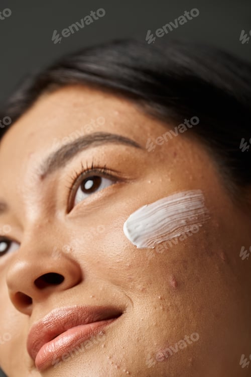 Preview: close up photo of young asian woman with brunette hair and treatment cream on acne prone skin