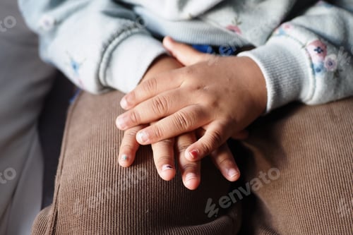 Preview: child suffering from itching skin on hand