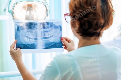 Preview: A dentist examines orthopantomogram in her hands