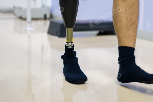 Preview: Prosthesis after foot injury and impairment treat