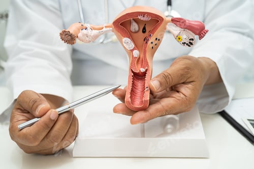 Preview: Uterus, doctor with anatomy model for study diagnosis and treatment in hospital.