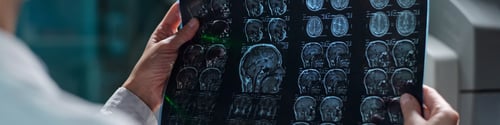 Preview: Examining Medical Scans on Transparent Lightboard