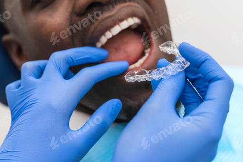 Preview: Close-up of a dental hygienist fitting a retainer during a patient's dental checkup in the clinic.