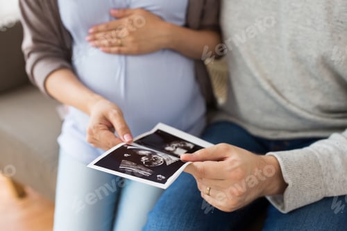 Preview: close up of couple with baby ultrasound images