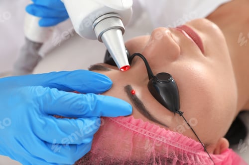 Preview: Woman undergoing laser tattoo removal procedure in salon, closeup