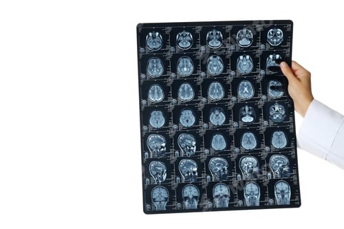 Preview: PNG, MRI images of a human head in the hands of a doctor, isolated on white background