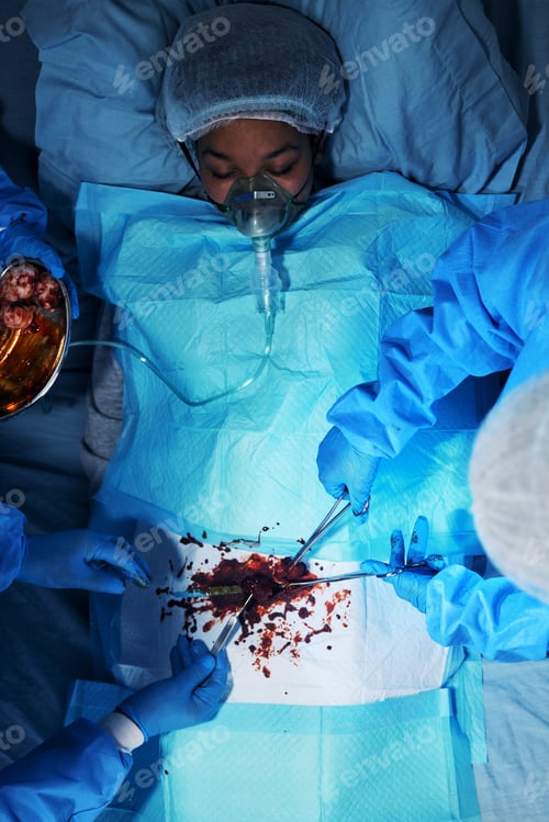 Preview: Surgery, patient and medical tools with hands with blood at hospital for cardiology with teams of d