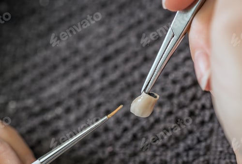 Preview: Paint a tooth crown