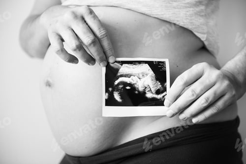 Preview: Pregnant woman showing fetus ultrasound photo