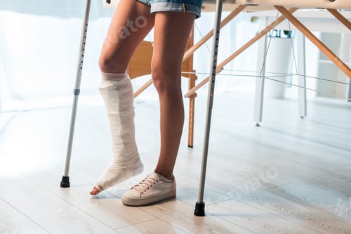 Visualização: cropped view of fractured woman using crutches to stand in clinic