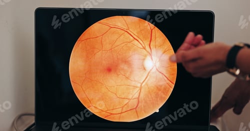 Preview: Hands, eye scan and screen in optometry for doctor, consultation and examination for vision health.