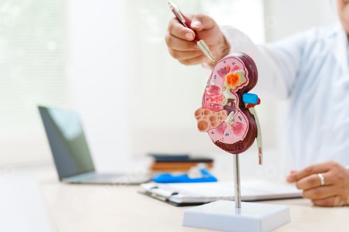 Preview: A doctor uses an anatomical kidney model to explain renal diseases, treatments, and diagnostics