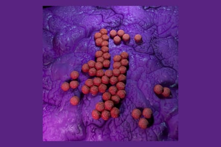 Visualização: Bactérias MRSA: visão microscópica