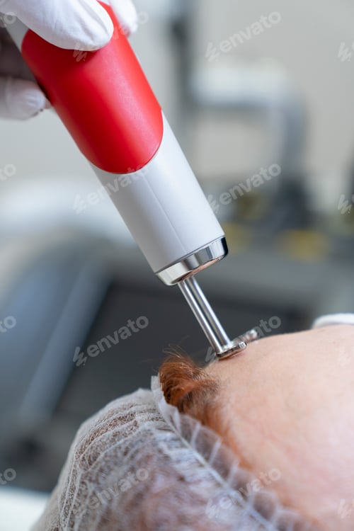 Preview: Close up of aesthetic laser ultrasound cosmethic device