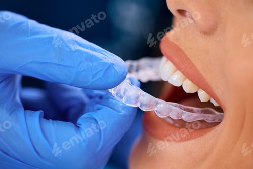 Preview: Close up of woman getting dental aligner at dentist's office.