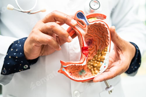 Preview: Stomach disease, doctor holding anatomy model for study diagnosis and treatment in hospital.