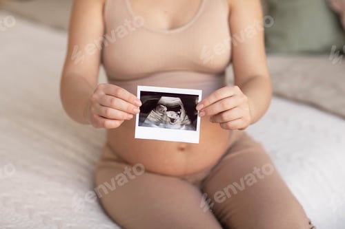 Preview: a pregnant girl holds in her hands a photo from an ultrasonic study of her unborn child