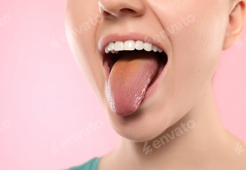 Preview: Gastrointestinal diseases. Woman showing her yellow tongue on pink background, closeup