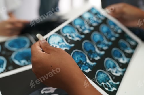 Preview: Group of doctors looking at X-ray on medical conference, discussing issues