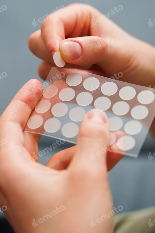 Preview: Skincare concept with acne patches prepared for skin treatment