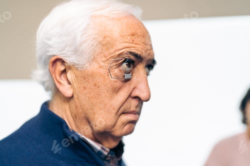 Preview: Senior Patient with Eyelid Speculum Applied for Glaucoma Laser Surgery